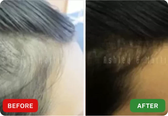 Roota Hair Serum Customer ~Lisa P.